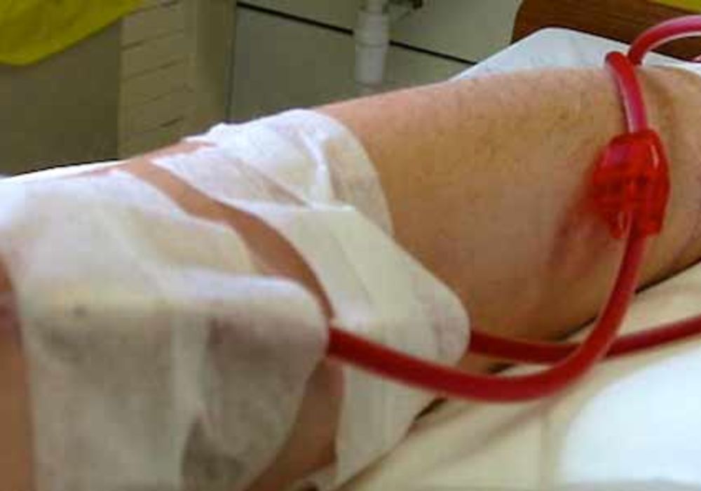 Antibiotic Therapy Benefits Haemodialysis Patients