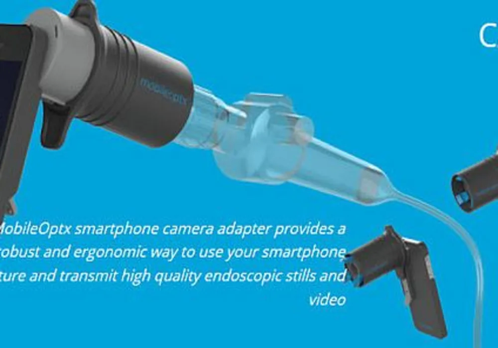 Smartphone Camera Tool Captures Endoscopic Images