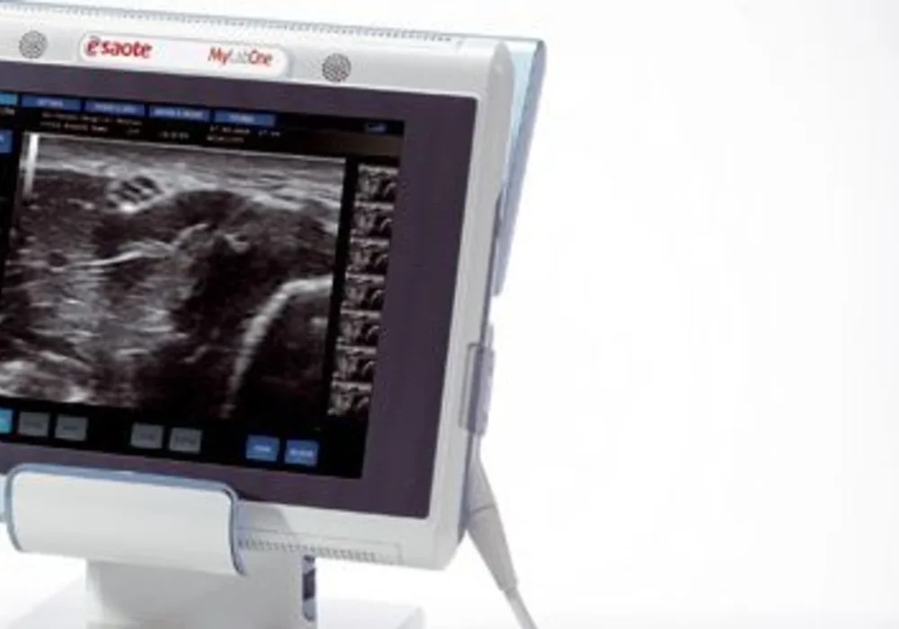 Esaote Launches Tablet-Size Vascular Ultrasound System  