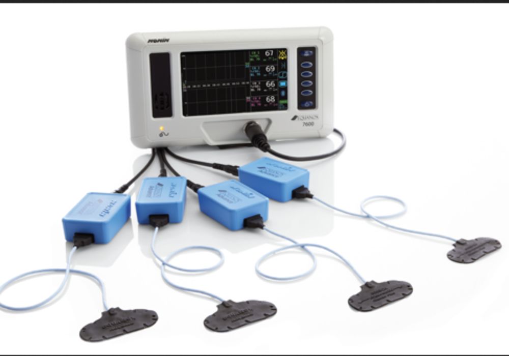 Terumo to Distribute Nonin&#039;s EQUANOX&trade; 7600 Regional Oximetry System in the U.S.