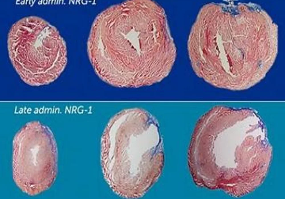 Heart muscle cells regenerate the fastest in the first six months of life