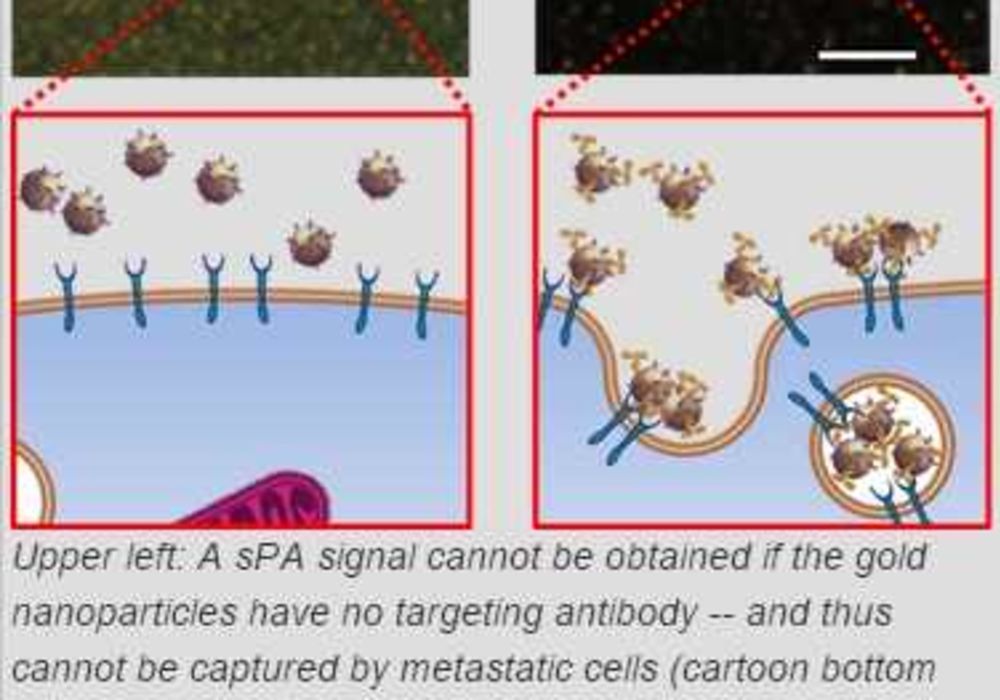 spectroscopic photoacoustic (sPA) imaging system