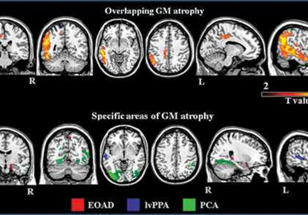 Axial and sagittal MR images 