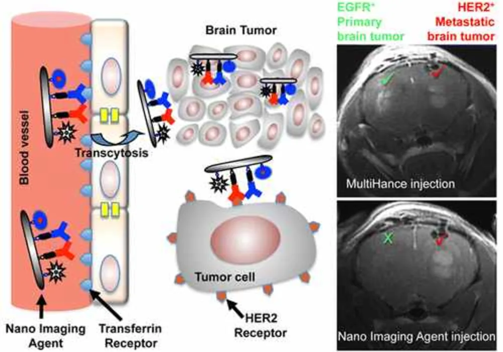 Noninvasive MRI diagnostic method