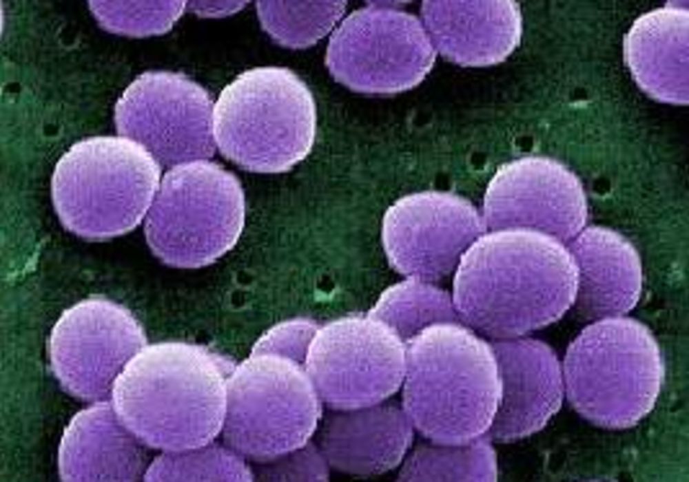 A strain of Staph bacteria