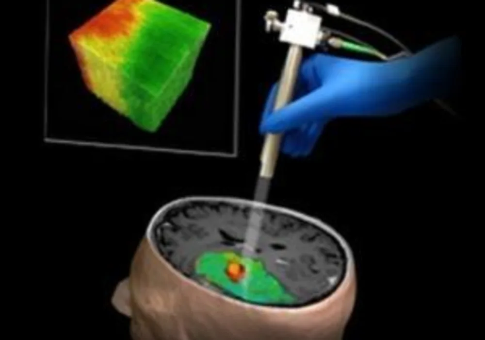 A colour-coded map of a patient&#039;s brain