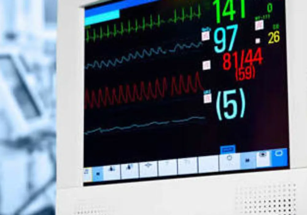 Cardiac monitor  