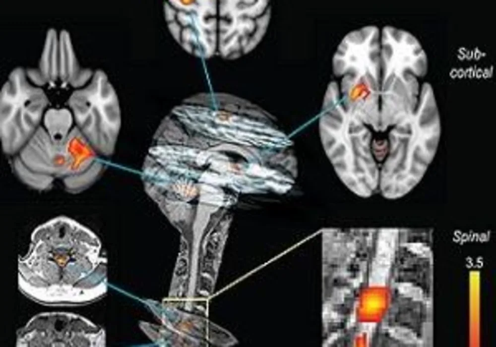 Neural correlates of motor sequence learning