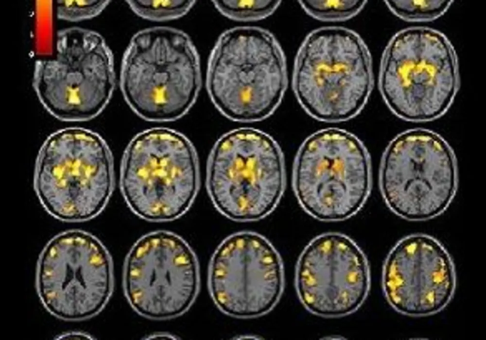 T1-weighted MR imaging exam of the brain