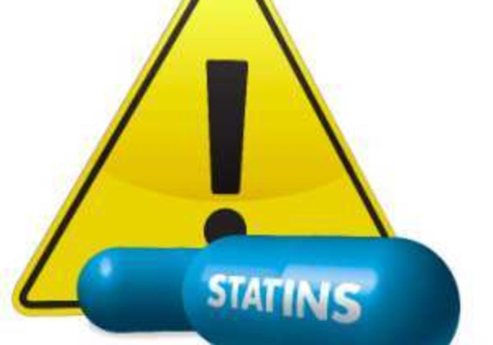 Statins 