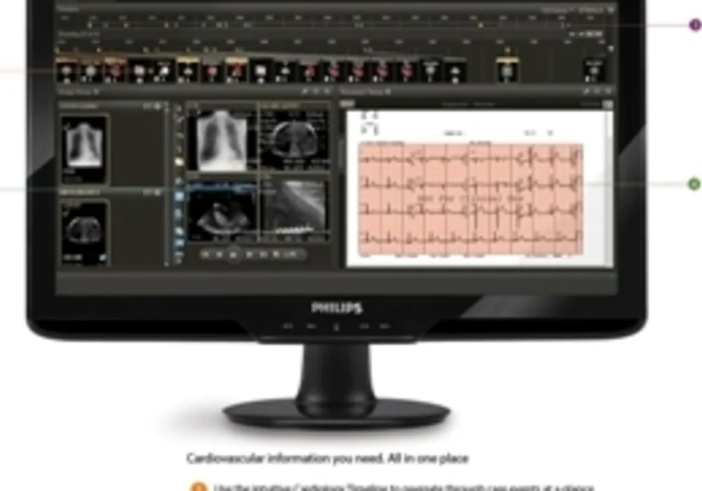 Philips new integrated Cardiology Solutions