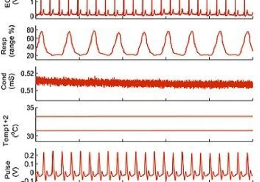 signals recorded during anaesthesia