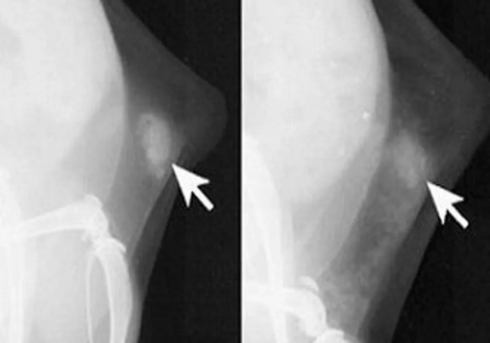 microcalcifications in normal mice (left) and those with dense breast tissue