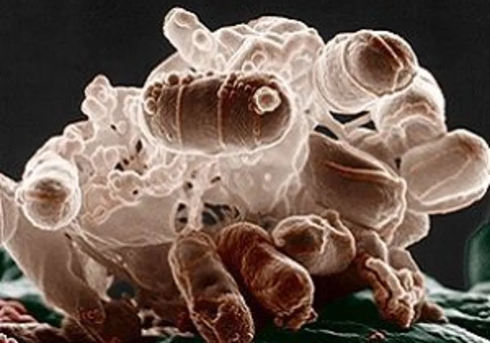 a micrograph of a cluster of E. coli bacteria