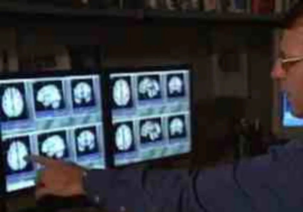 Radiologist reviewing brain MRI scans