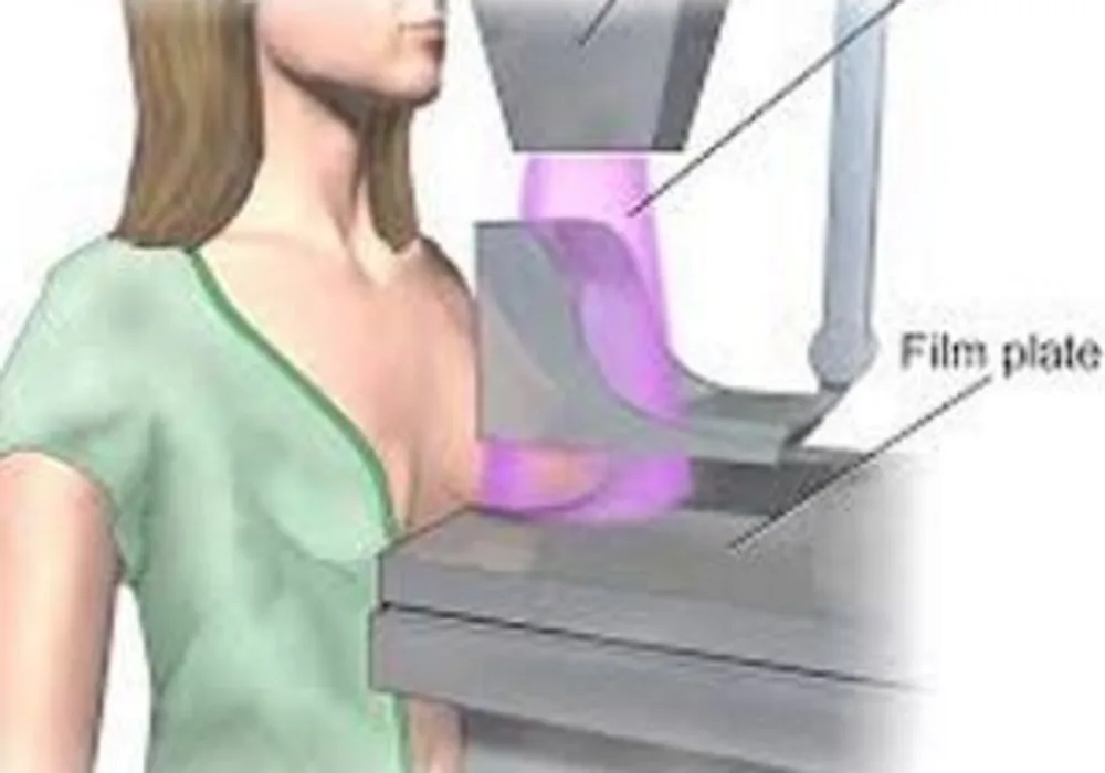 illustration of a mammogram