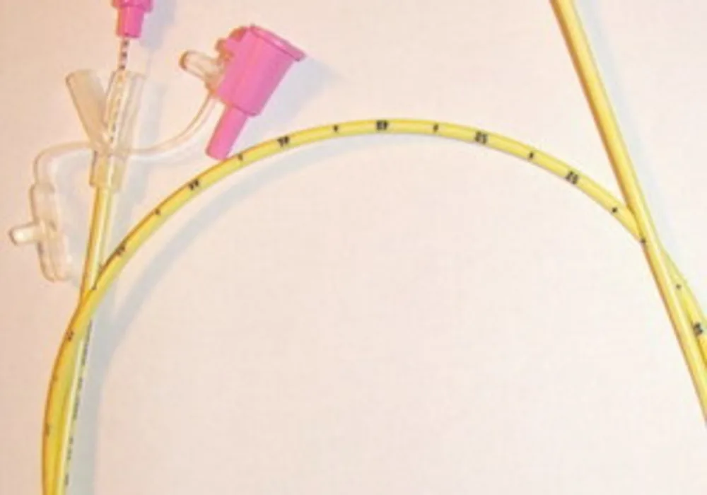 Nasogastric feeding tube