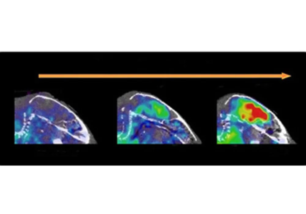 PET-scans of the brain of a mouse at 8, 12 and 18 months old with the antibody against so-called protofibrils &copy; 2016 Uppsala Universitet