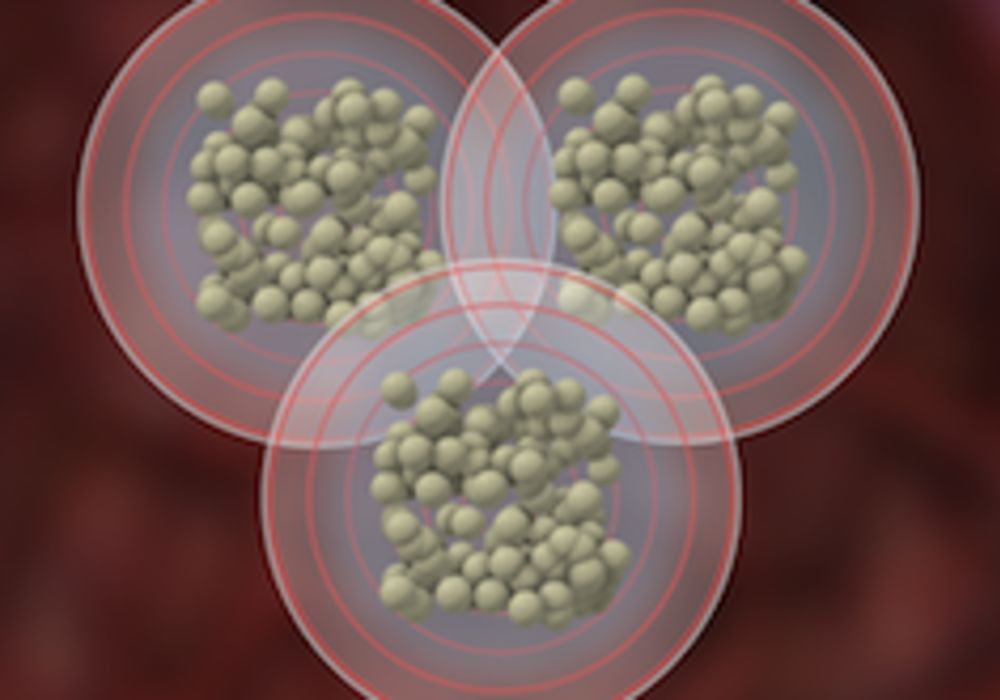 Cluster of SIR-Spheres&reg; Y-90 resin microspheres (Source: http://www.sirtex.com/eu/newsroom/media-materials-library/images/)