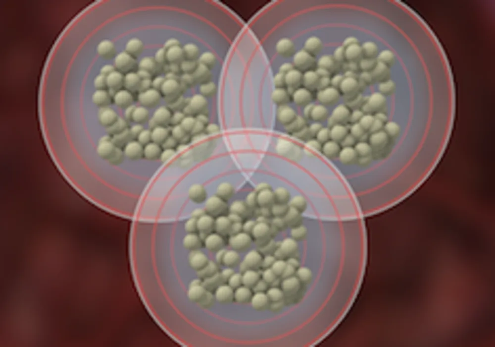 Cluster of SIR-Spheres&reg; Y-90 resin microspheres (Source: http://www.sirtex.com/eu/newsroom/media-materials-library/images/)