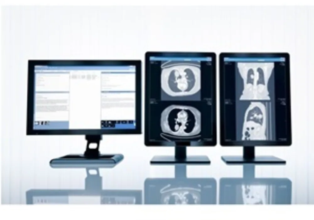 Large London Hospitals Invest in Imaging IT Solution from Sectra