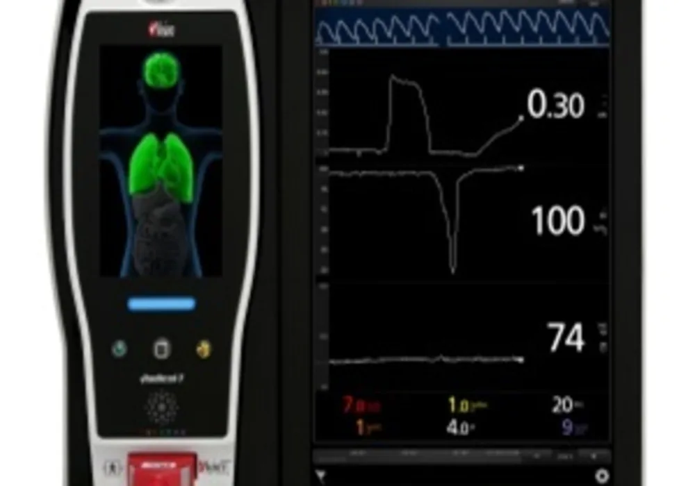 Study on Relationship Between Masimo&rsquo;s ORI&trade;&amp; Arterial Partial Pressure of Oxygen During Surgery