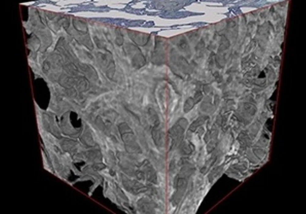 The image shows 2 mm cubes of lung tissue imaged by microCT. In (A) is normal lung tissue and in (B) is IPF lung tissue. The very fine lung structure seen in the normal lung tissue is destroyed by IPF and replaced by the much thicker scar tissue seen in (