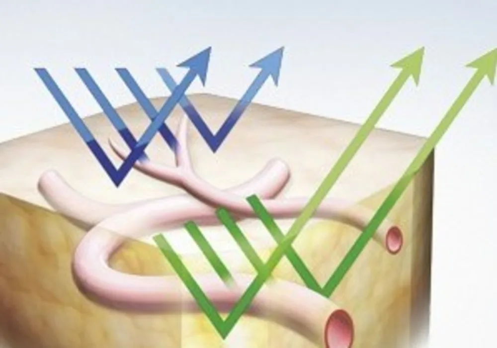 Narrow Band Imaging (source: Olympus Medical Systems)