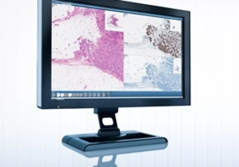 University hospital in Finland Invests in Digital Pathology from Sectra