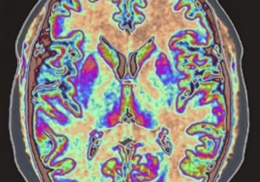 Colourised magnetic resonance image of the human brain