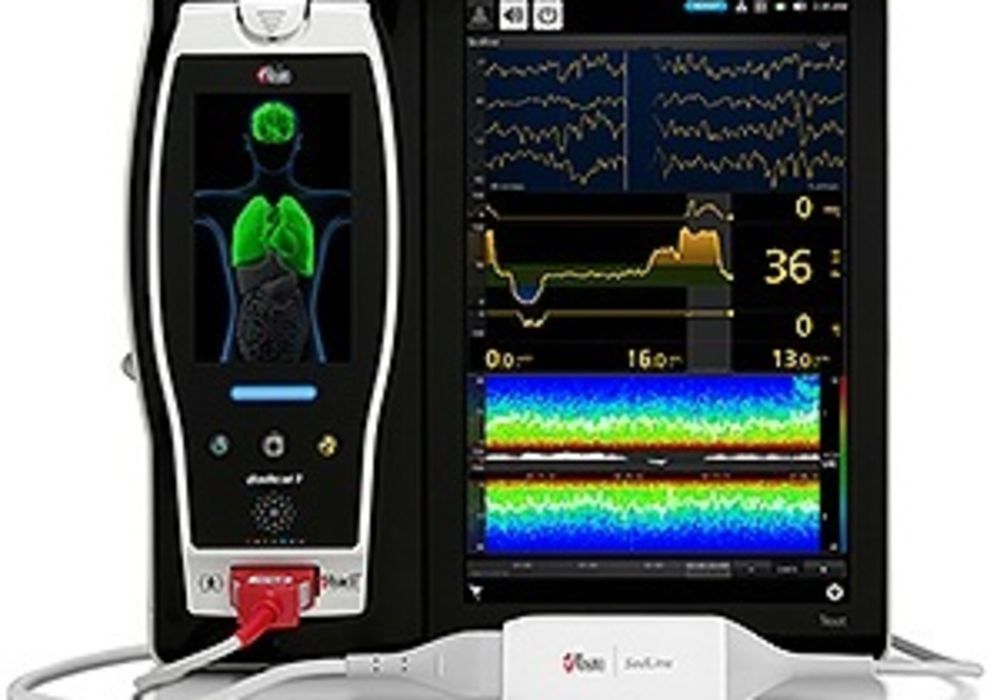 Masimo to Showcase Next Generation SedLine&reg; Brain Function Monitor at 2016 Euroanaesthesia Congress