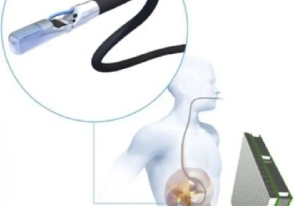 The EndoTOFPET-US scanner composed of the endoscopic and abdominal detectors.  DESY/Stuhrmann