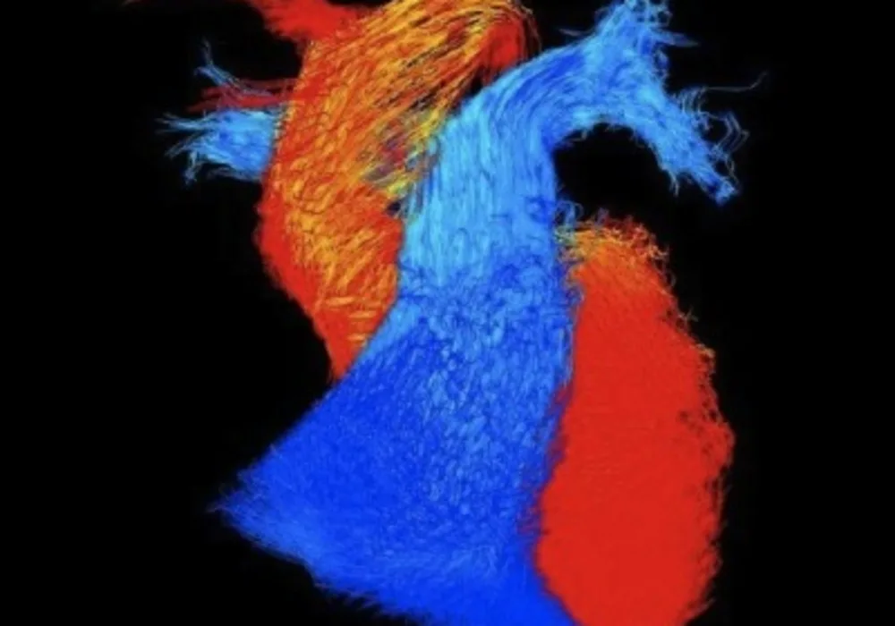 4D Cardiac MRI Wins BHF Research Image Award