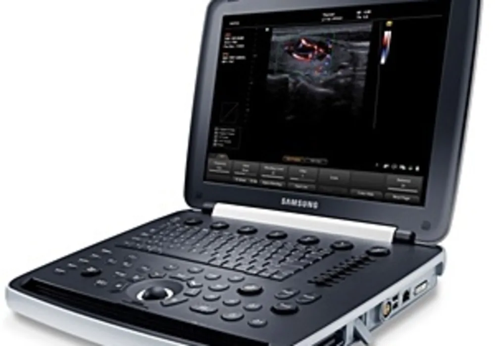 Samsung Medison Releases the HM70A With Plus, Delivering Excellent Mobility in Various Medical Environment