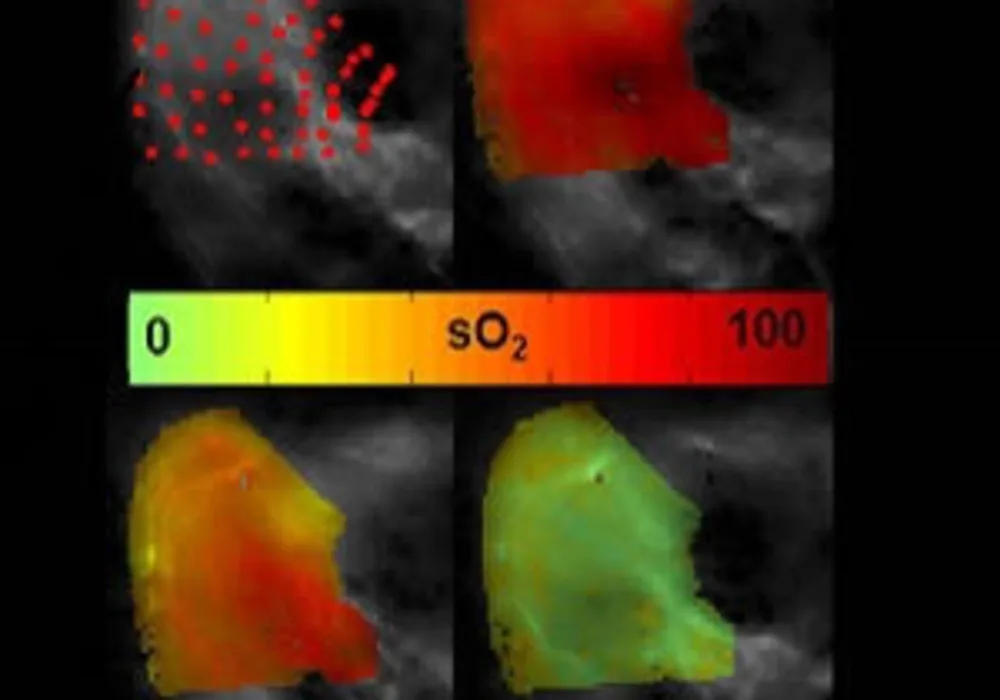 New Imaging Method for Showing Oxygen In Tissue