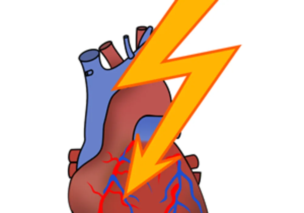 Therapeutic Hypothermia Decreases Chances of Survival