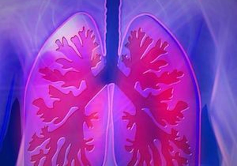 Graphic of lungs, credit Pixabay