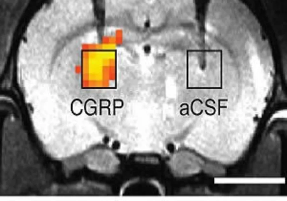 A Safer Way to Image Molecules in the Brain