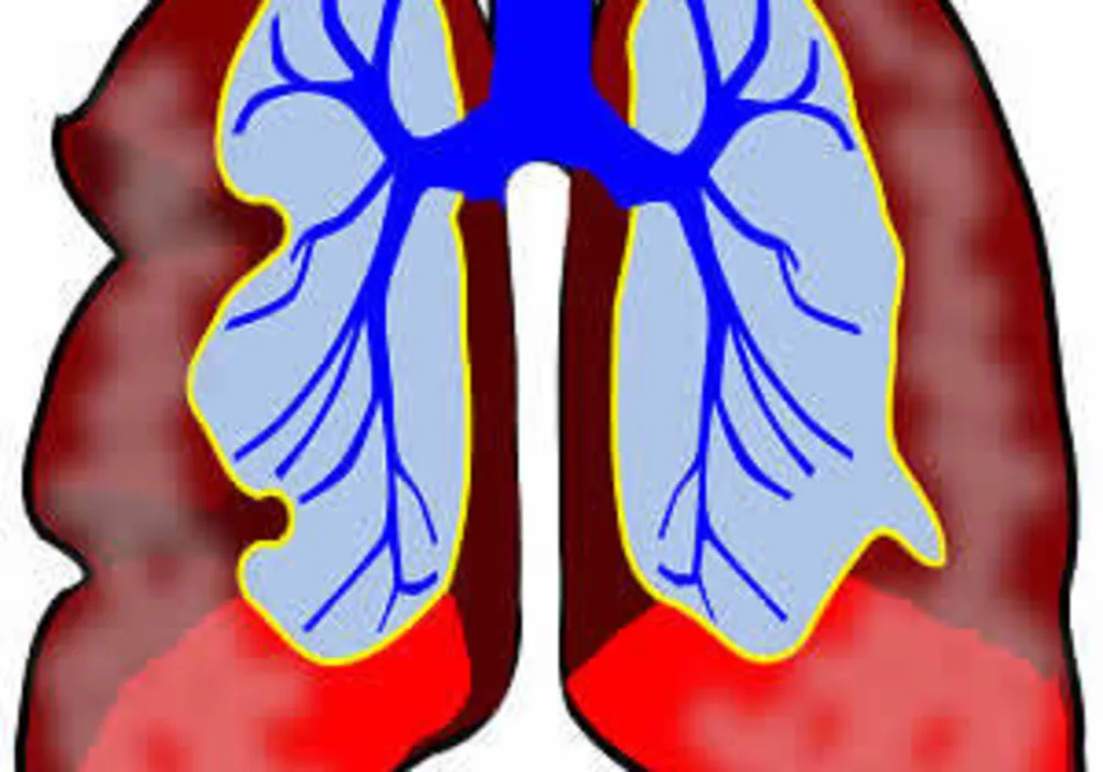 The Imaging of Small Pulmonary Nodules