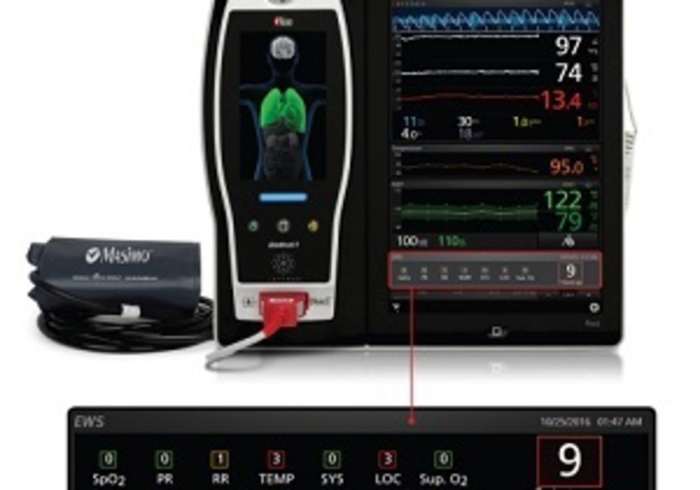 Masimo Announces the Full Market Release of Early Warning Score (EWS) with the Root&reg; Patient Monitoring and Connectivity Hub