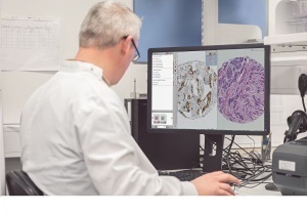 Philips Speeds Up Research and Biomarker Discovery with Major Upgrade to the Xplore Image and Data Management Platform