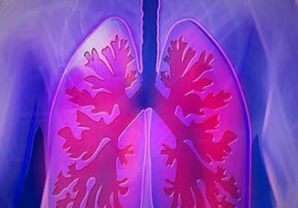 Cost-effective Lung Cancer Screening Programmes