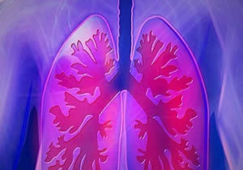 Lung Cancer Screening: Its Impact on Surgical Volume