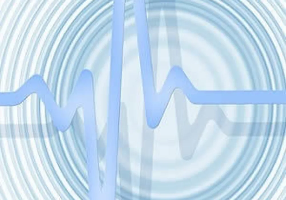 #ESC17: Implanted Cardiac Monitors Detect Undiagnosed Atrial Fibrillation 