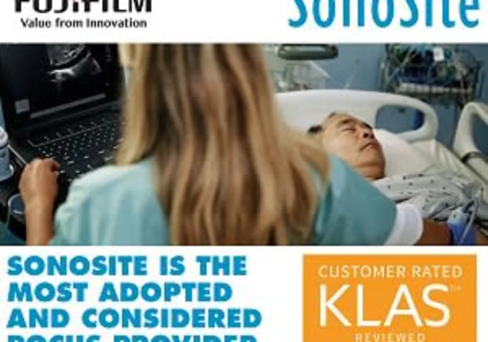 FUJIFILM SonoSite most adopted and considered vendor for point-of-care ultrasound according to KLAS