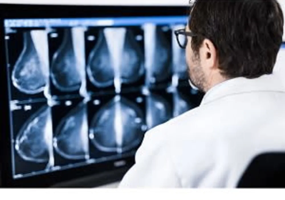 Sectra to deliver nationwide imaging IT solution to Dutch breast screening program