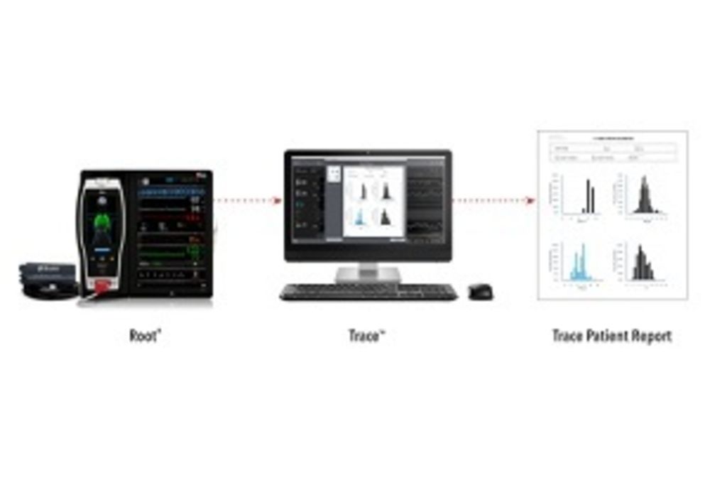 Masimo Announces U.S. Release of Trace&trade; Data Visualization and Reporting Tool