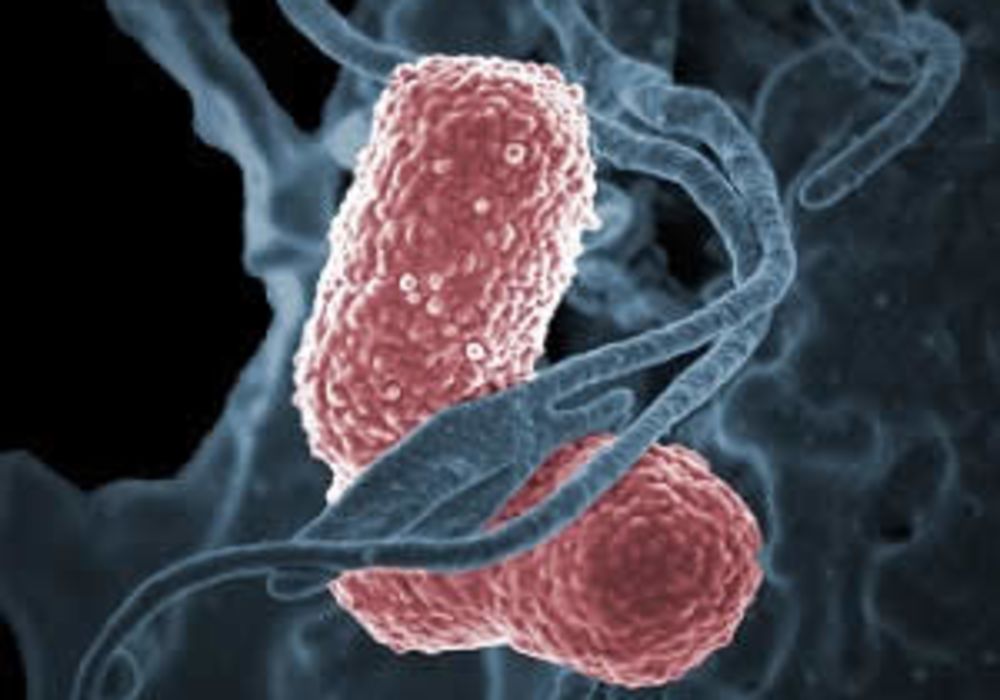 Transmission of antibiotic-resistant Enterobacteriaceae in ICUs