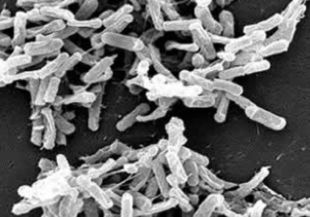 Sleeping with the enemy: C.difficile infection in ICU 