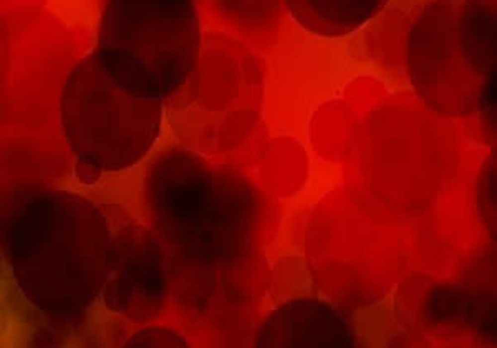 Managing bleeding on OACs - new expert consensus